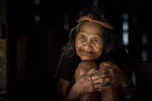 体毛が濃い女性の特徴とは何ですか？